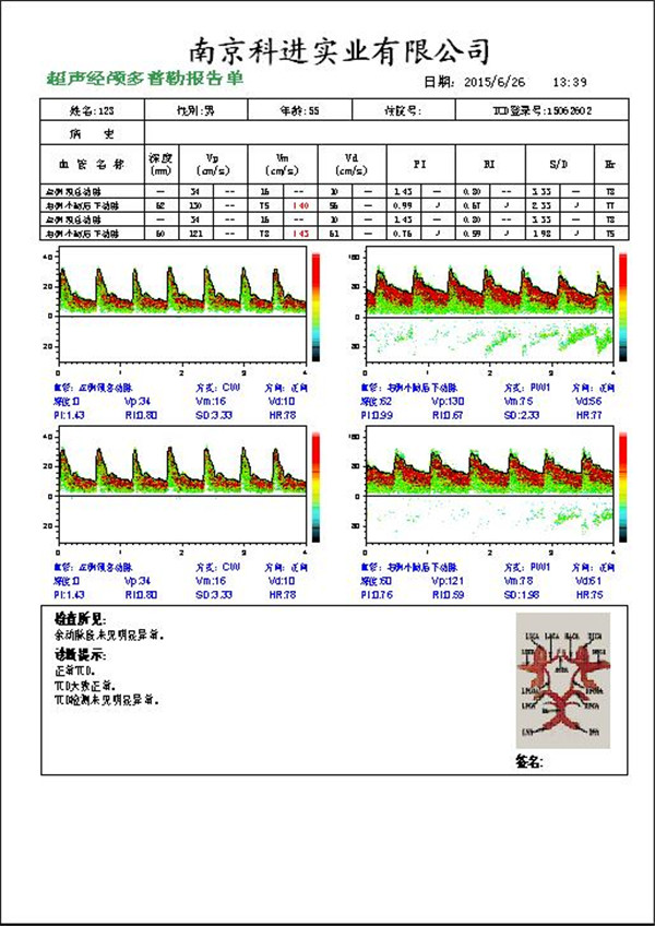 經顱多普勒報告圖.jpg