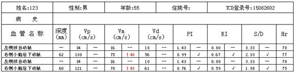 經顱多普勒報告上部表格含義.jpg
