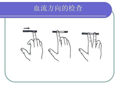 超聲經顱多普勒對顱內血流方向的檢查