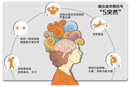 心腦血管病別等發作才篩查，經顱多普勒TCD超聲檢測心腦血管